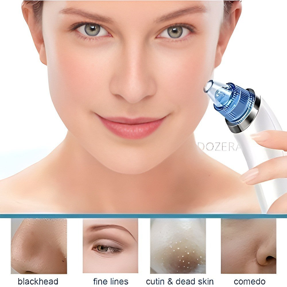 DermaSuction™ Blackhead Vacuum & Deep Pore Cleanser