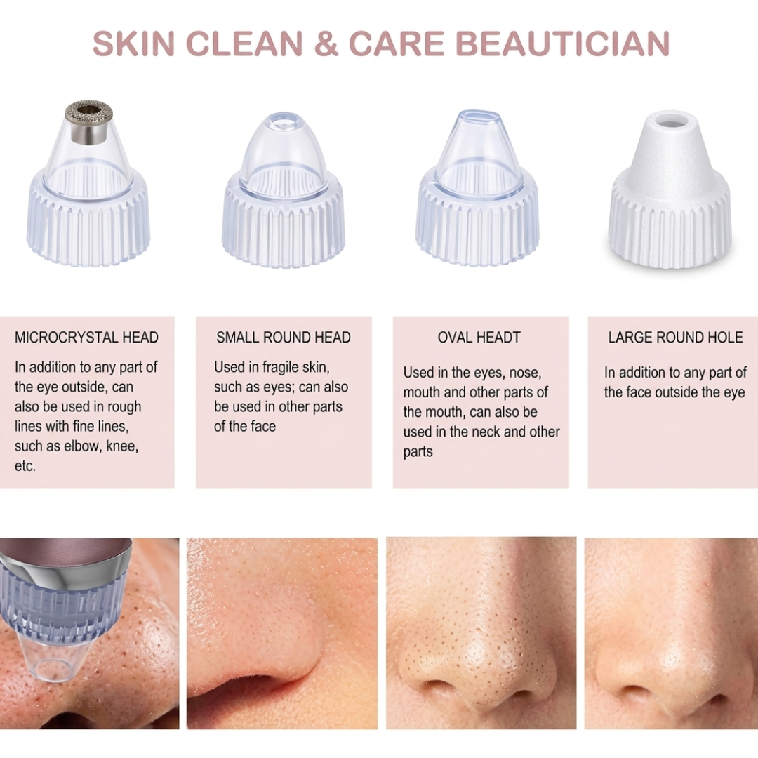 DermaSuction™ Blackhead Vacuum & Deep Pore Cleanser